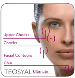Skin Needling