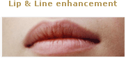 Facial Rejuvenation - dermal fillers