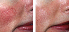 Oxygen Rx Facial Circadia by Dr Pugliese