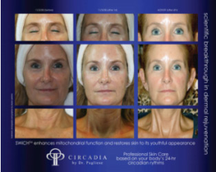 SWiCH Epidermal Repair System by Circadia by Dr Pugliese